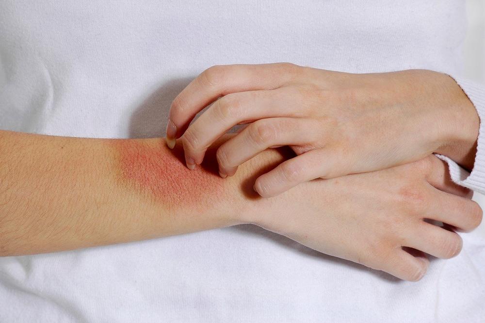 NAŠU DECU SVE VIŠE POGAĐA OVA BOLEST: Roditelji ne primećuju OVE PRVE SIMPTOME, pa dodatno pogoršavaju stanje!