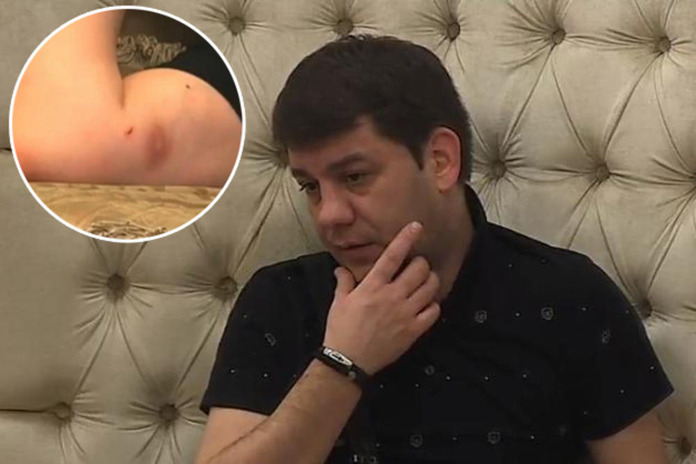 ZAŠTO NIKO NE KAZNI OVU ŽENU KAO I MIKIJA! Jelena opet TUKLA Marinkovića, pokušala da mu izvadi OČI pred kamerama