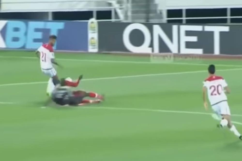 NI U NAJGOREM HORORU OVO NIJE VIĐENO: Najjeziviji prelom noge ikada! Igrači i sudija plakali, meč odmah prekinut!