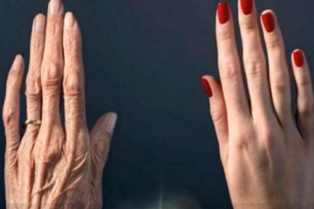 DA LI SE NA RUKAMA VIDI SIMPTOM TEŠKE BOLESTI?