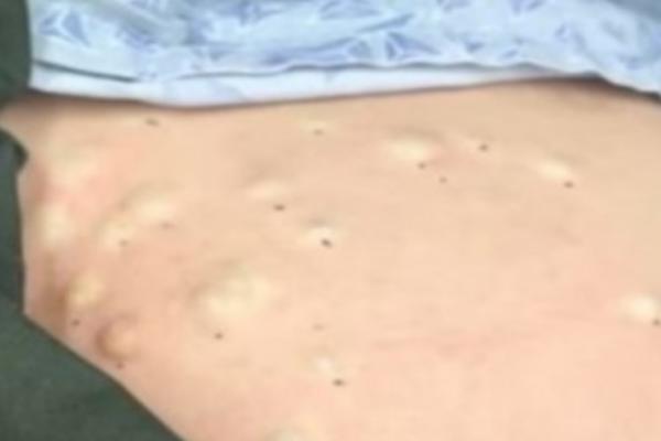 LEĐA OVE ŽENE SU PREKRILE CRNE TAČKICE: Ujutru je jedva ustala u bolovima, nije imala pojma ŠTA SE DESILO! (VIDEO)