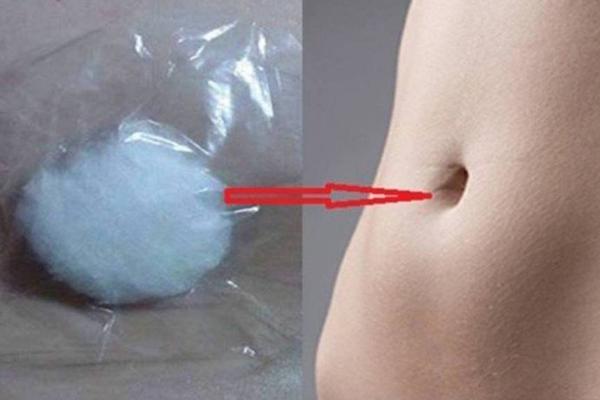 NATOPILA JE VATU U ALKOHOL I STAVILA U PUPAK: Kada je nakon 25 minuta izvadila, NIJE VEROVALA ŠTA VIDI!