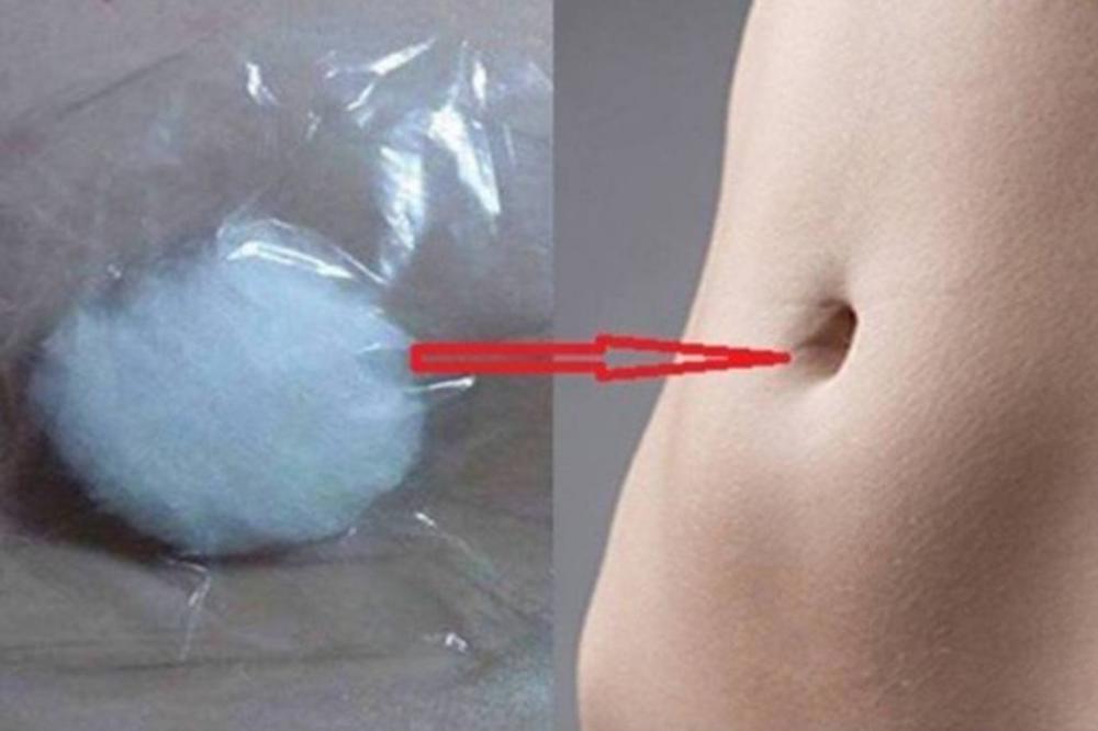 NATOPILA JE VATU U ALKOHOL I STAVILA U PUPAK: Kada je nakon 25 minuta izvadila, NIJE VEROVALA ŠTA VIDI!