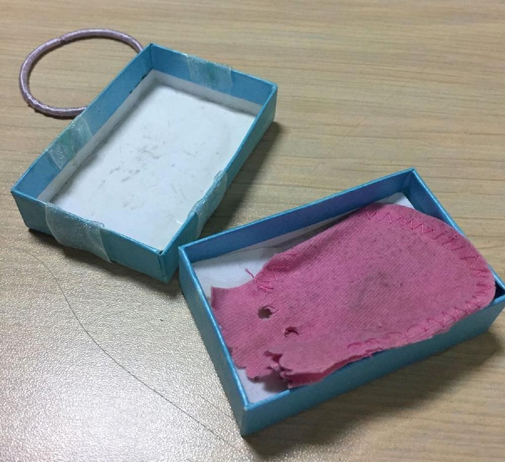 Kutija u kojoj su zlatnici 