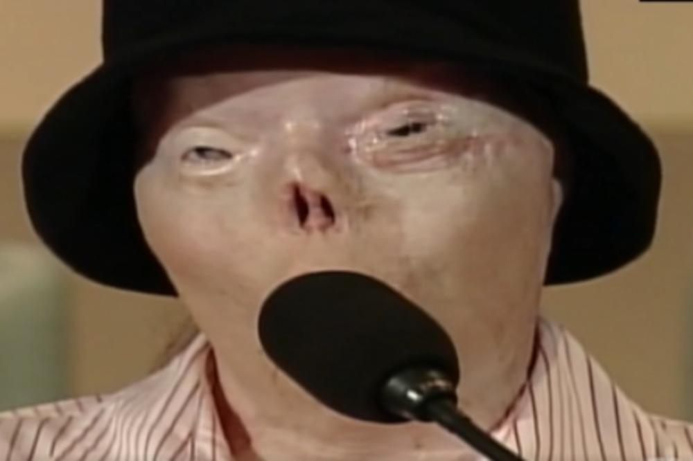 U UDESU JOJ JE IZGORELO CELO LICE: Svoj strašni izgled koristila je da upozori druge vozače, a sada je umrla