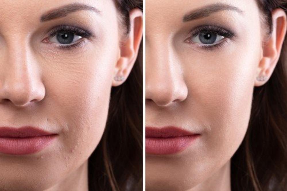 OVAJ TRIK STRUČNJAKA ZA PODMLAĐIVANJE NEMOJTE PROPUSTITI: Previše je JEDNOSTAVNO, zahteva MINIMUM truda