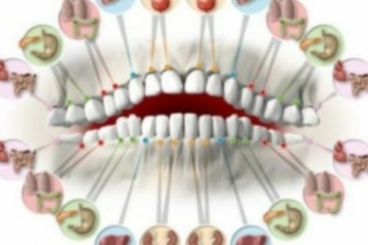 Uzroci i liječenje zubobolje