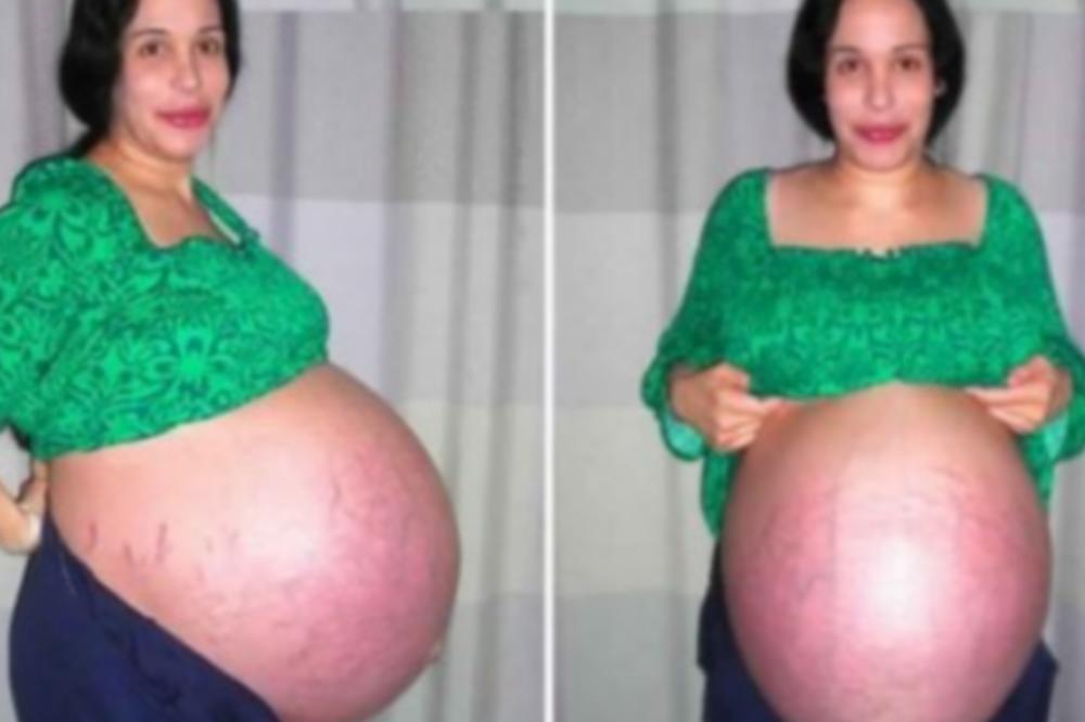 DA LI SE SEĆATE OVE MAME: Rodila OSMORKE pa snimila filmove za odrasle, a evo kako izgleda nakon 10 godina! (FOTO)