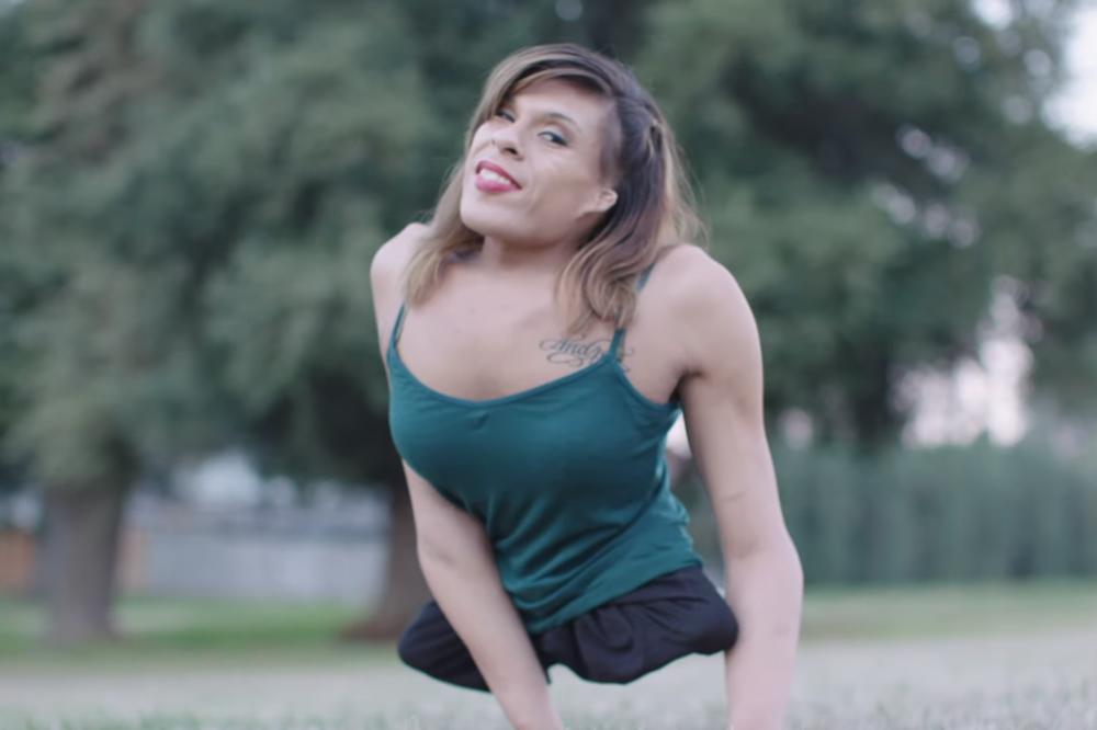 ROĐENA JE SA POLA TELA, A ONDA JE I PROMENILA POL: Danas je srećna žena koja je pronašla i ljubav! (VIDEO)