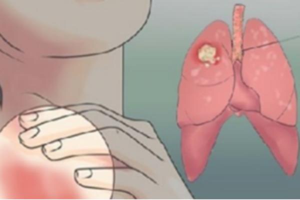 AKO UOČITE OVO NA VAŠEM TELU, ISTOG TRENUTKA IDITE LEKARU: Naizgled je bezazleno, a radi vam O GLAVI!