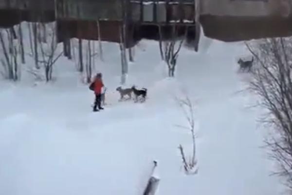 MALU DEVOJČICU JE NAPAO ČOPOR BESNIH PASA: Umalo je na smrt izujedali, a onda se desilo NEŠTO NEOČEKIVANO! (VIDEO)