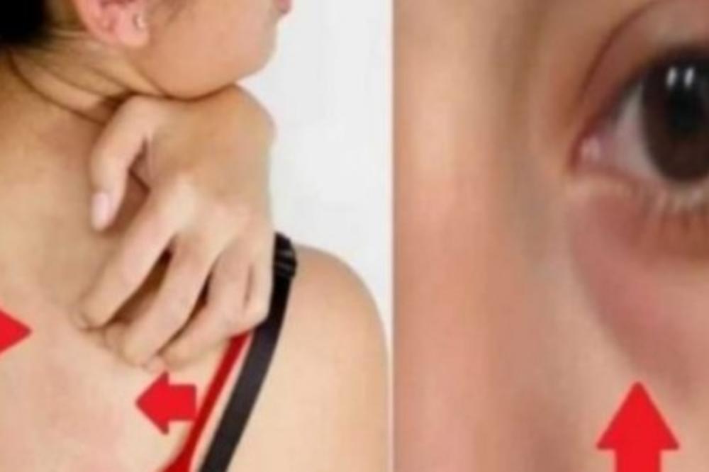 MANJAK ENERGIJE I SVRAB KOŽE SU SIMPTOMI OZBILJNE BOLESTI: Nemojte se igrati s ovim, ne vrede vam NI LEKOVI!