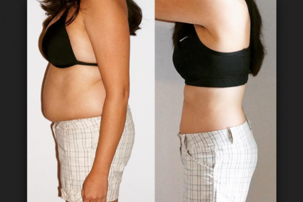 OVAJ ZAČIN PRŽI SALO!!! Napravite ovu DOMAĆU SMESU i budite spremni za PLAŽU!