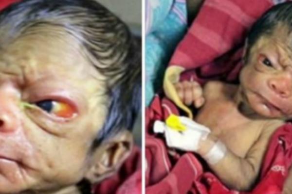 NA SVET JE DOŠLA BEBA STARAC: Svi lekari su u šoku, a ono što roditelji rade je neverovatno! (VIDEO)