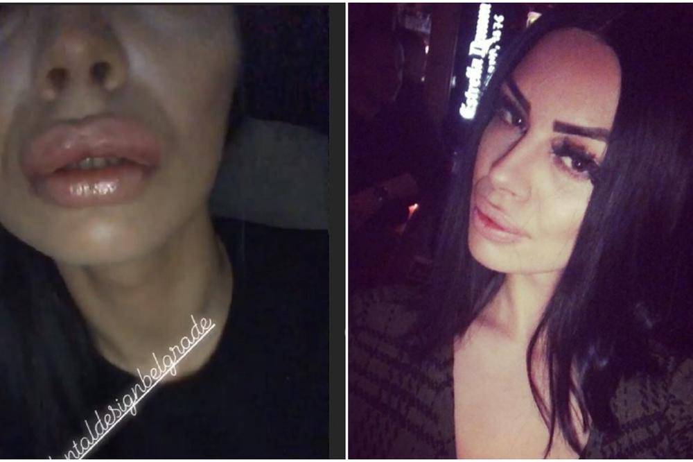 KAŽE DA JE TEŠKO BOLESNA, BORI SE SA ZDRAVLJEM, A ONDA OVO: Zerina Hećo OPET POVEĆALA USTA, jeziv PRIZOR na SNIMKU