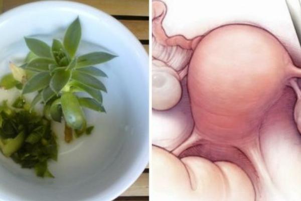 RUSKI DOKTORI PREPORUČUJU OVAJ LEK: Tvrde da pomaže kod svih GINEKOLOŠKIH BOLESTI!