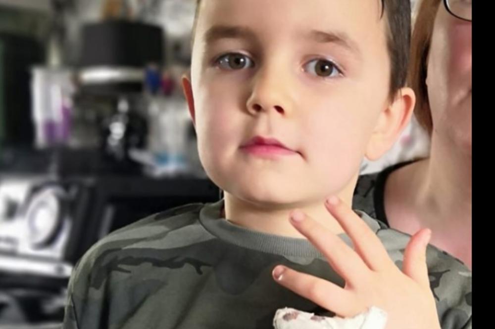 DEČAKU (7) ODSEČEN PRST U ŠKOLI! Reakcija nadležnih je bila SKANDALOZNA, tvrde roditelji