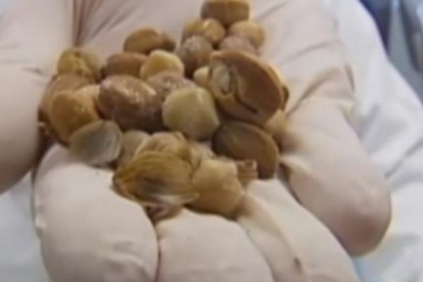 NAJVEĆE NAUČNO OTKRIĆE DO SADA: Ovo VOĆE ŠTITI OD TEŠKIH BOLESTI i jako je DELOTVORNO! (VIDEO)