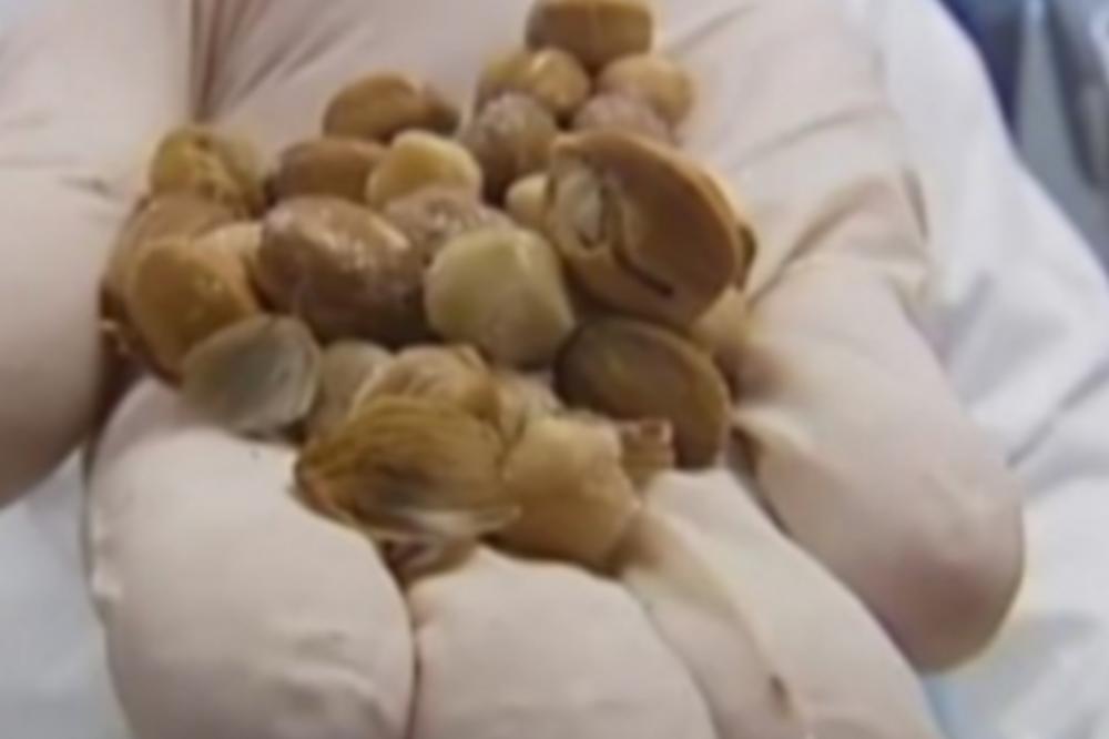 NAJVEĆE NAUČNO OTKRIĆE DO SADA: Ovo VOĆE ŠTITI OD TEŠKIH BOLESTI i jako je DELOTVORNO! (VIDEO)