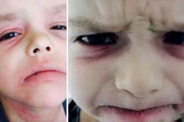 NIKO JOJ NIJE VEROVAO ŠTA SE DEŠAVA S NJENIM SINOM: A onda ga je snimila i ŠOKIRALA sve doktore! (VIDEO)