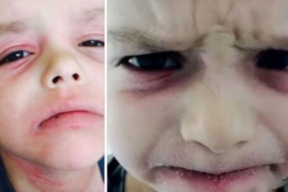 NIKO JOJ NIJE VEROVAO ŠTA SE DEŠAVA S NJENIM SINOM: A onda ga je snimila i ŠOKIRALA sve doktore! (VIDEO)