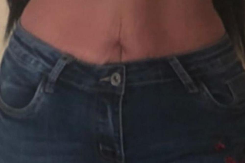 STOMAK PUN STRIJA I OŽILJAKA: Zadrugarka se OGOLILA, pa poslala poruku koja nikog ne ostavlja ravnodušnim... (FOTO)