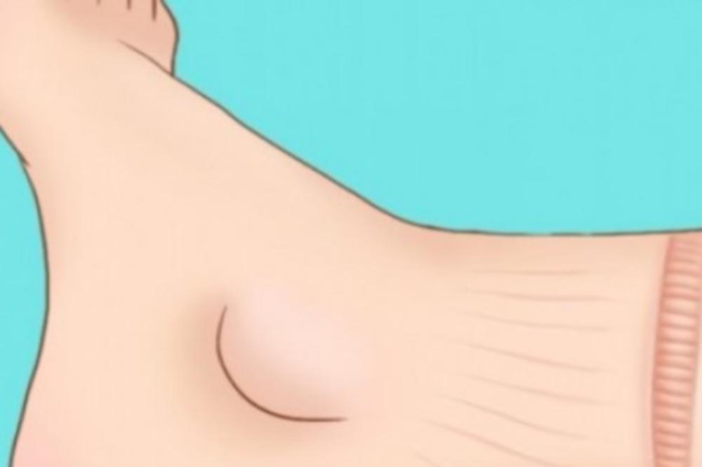 UPOZORAVAJUĆI ZNAKOVI DA VAŠE SRCE NE RADI KAKO TREBA: Pogledajte obavezno svoje noge, posebno stopala!