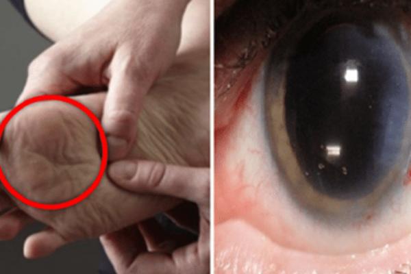 NIKAKO NE IGNORIŠITE: Ako se ove stvari dešavaju sa vašim stopalima, možda imate OZBILJAN ZDRAVSTVENI PROBLEM!