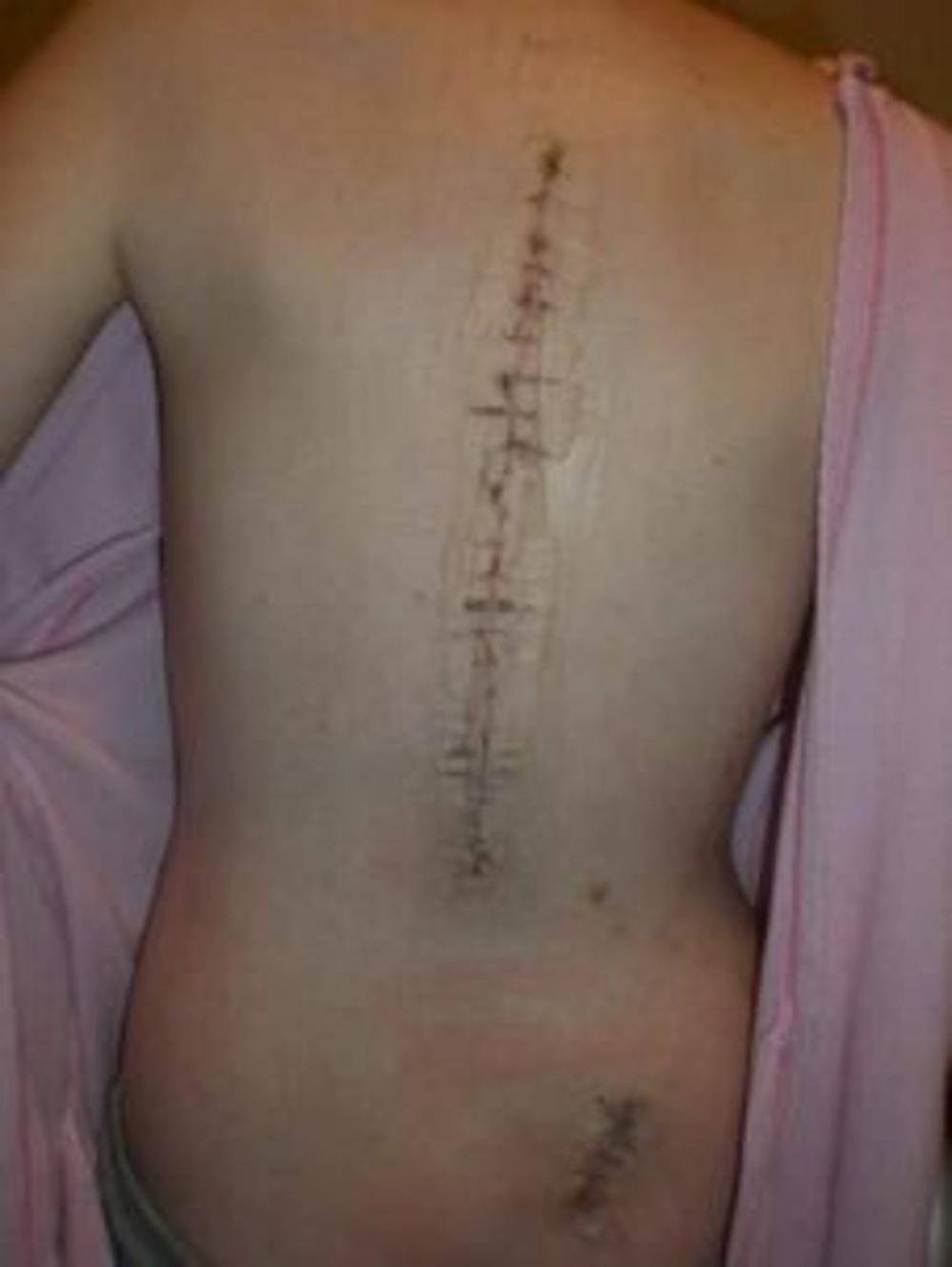 Imala je tešku operaciju 