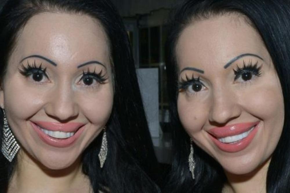 BLIZNAKINJE SE BUKVALNO UNIŠTILE: Dale preko 150.000 funti na plastične operacije, a opet izgledaju ružno! (FOTO)