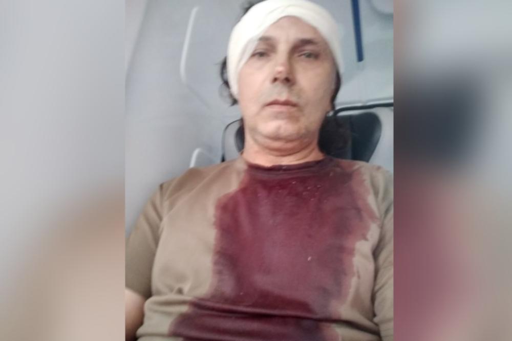 JEZIVA FOTKA! SUBOTIĆ SAV KRVAV, ZAVIJENA MU GLAVA: Ovako je pretučen Srba u Kaluđerici!