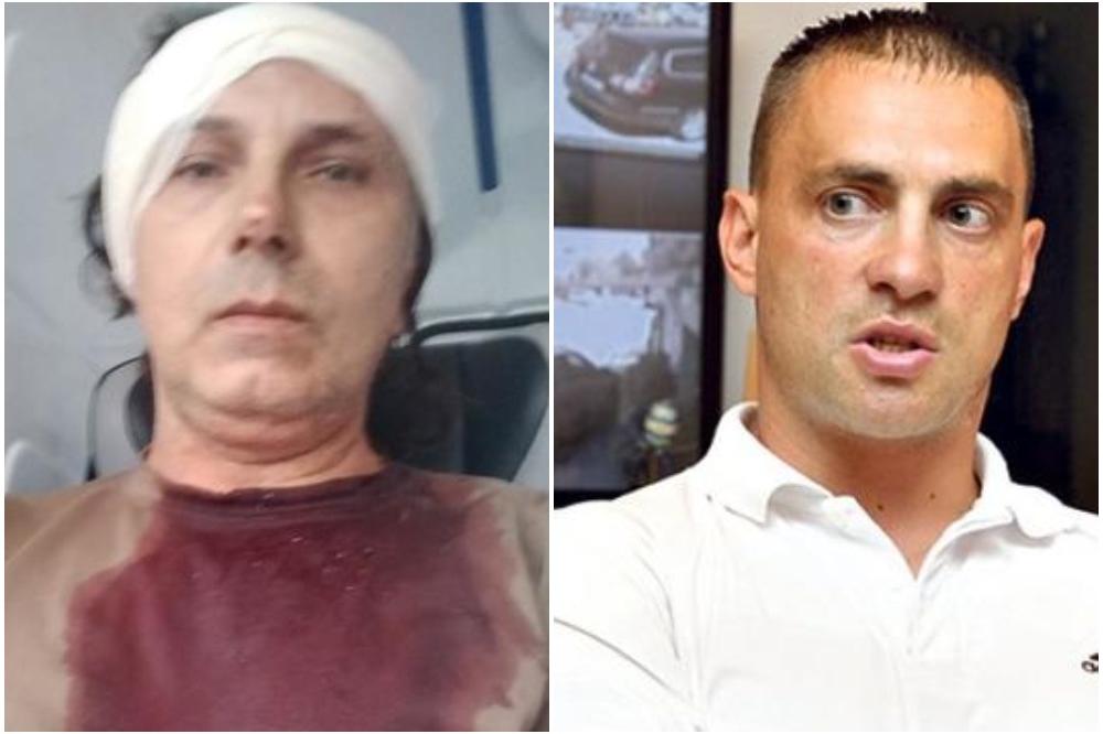 OGLASIO SE ČABARKAPA: Evo šta je rekao o ČOVEKU koji je RAZBIO GLAVU Srboljubu Subotiću!