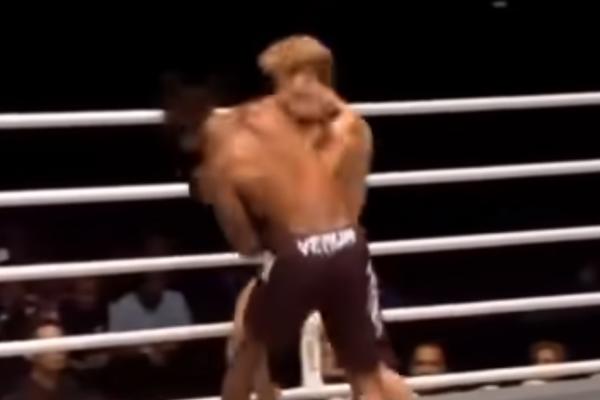 HOROR NA MMA: 1 udarac, 8 fraktura lobanje, operacija trajala 9 sati! Pogledajte kako mu posle toga izgleda lice!