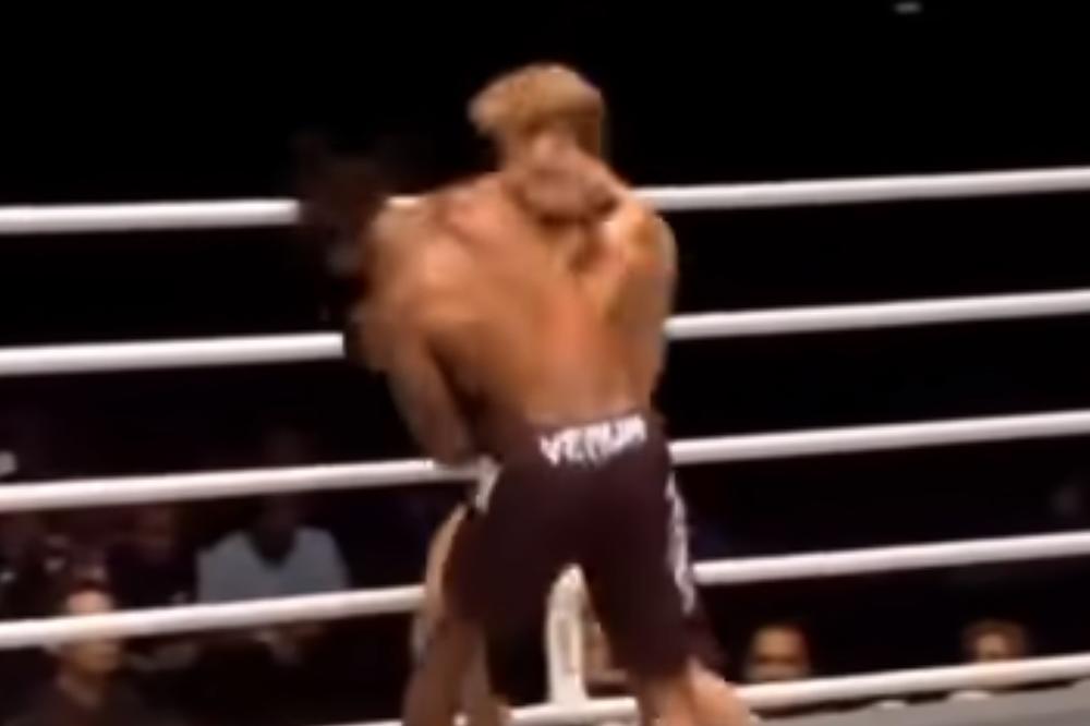 HOROR NA MMA: 1 udarac, 8 fraktura lobanje, operacija trajala 9 sati! Pogledajte kako mu posle toga izgleda lice!