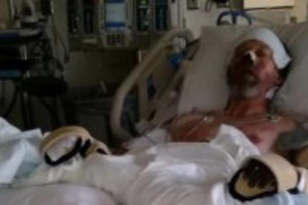 IGRAO SE SA PSOM I ON GA JE POLIZAO: Sada su ovom čoveku AMPUTIRANE OBE NOGE, a nos mu se RASPADA! UŽAS!