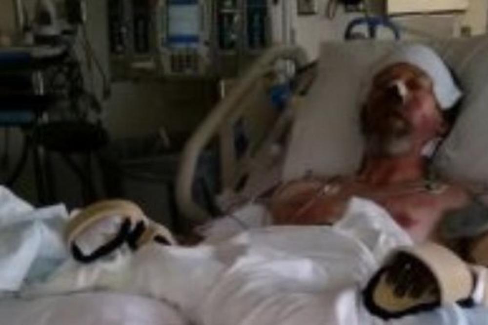 IGRAO SE SA PSOM I ON GA JE POLIZAO: Sada su ovom čoveku AMPUTIRANE OBE NOGE, a nos mu se RASPADA! UŽAS!