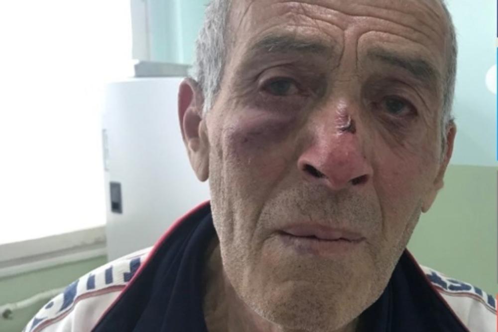OVO JE GLUVONEMI SRBIN KOG JE PRETUKAO ROSU! Šutirali su ga i udarali kundakom, BATINE SU BILE BRUTALNE! (FOTO)