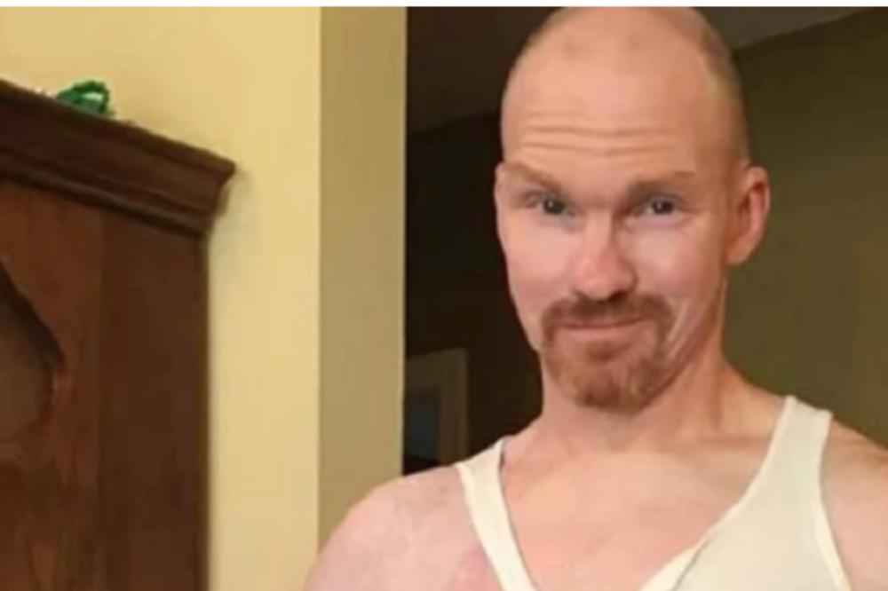 ČVOR JE POČEO DA OTIČE: Primetio je malu izbočinu na ruci, a samo nekoliko sati kasnije BORIO SE SA SMRĆU!