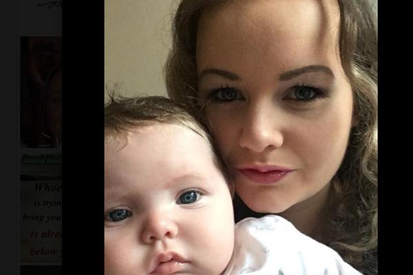 NAJTEŽA ODLUKA U ŽIVOTU: Morala je da dozvoli da ćerki (2) AMPUTIRAJU NOGE, a razlog za to je POTRESAN