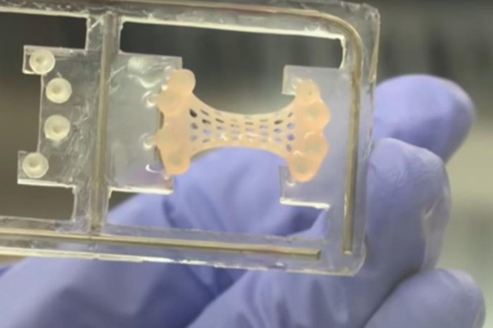 IZUM KOJI ĆE PROMENITI MEDICINU: Napravljena ZAKRPA ZA SRCE koja ovaj organ poptuno obnavlja nakon INFARKTA