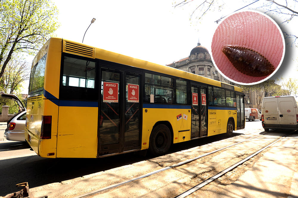 BEOGRAĐANKA SE LEČILA KOD NADRILEKARA, PA SE SRUŠILA U BUSU: Krv na sve strane, ispod zavoja vrvele PIJAVICE!