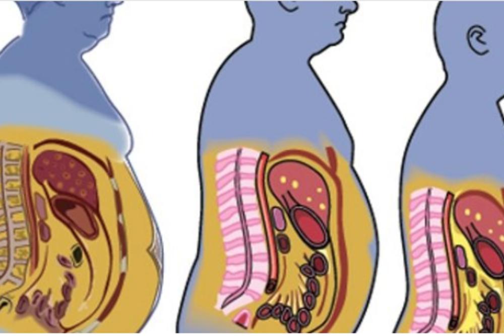IMATE PROBLEM SA SALOM NA STOMAKU, A NEMATE REŠENJE? Ovih pet stvari vam stvara tu muku! REŠITE IH SE!