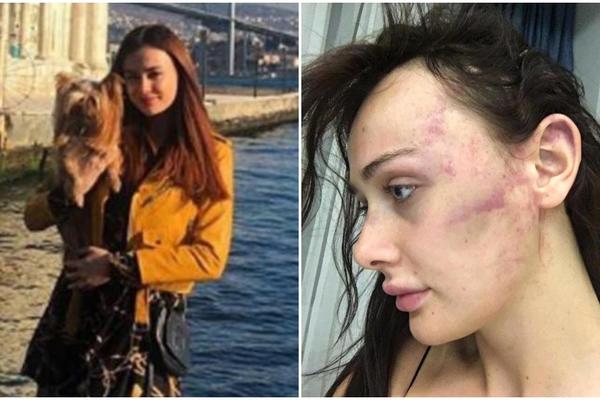 UPI*KILA SAM SE OD BOLA, IŽIVLJAVAO SE SATIMA! Srpska manekenka o mučenju od strane Turčina: Ostala sam bez svesti!