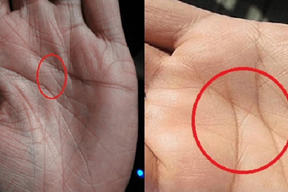 SAMO 3% LJUDI IMA SLOVO 'X' NA DLANU: Ako ste među njima, evo šta vas u životu čeka