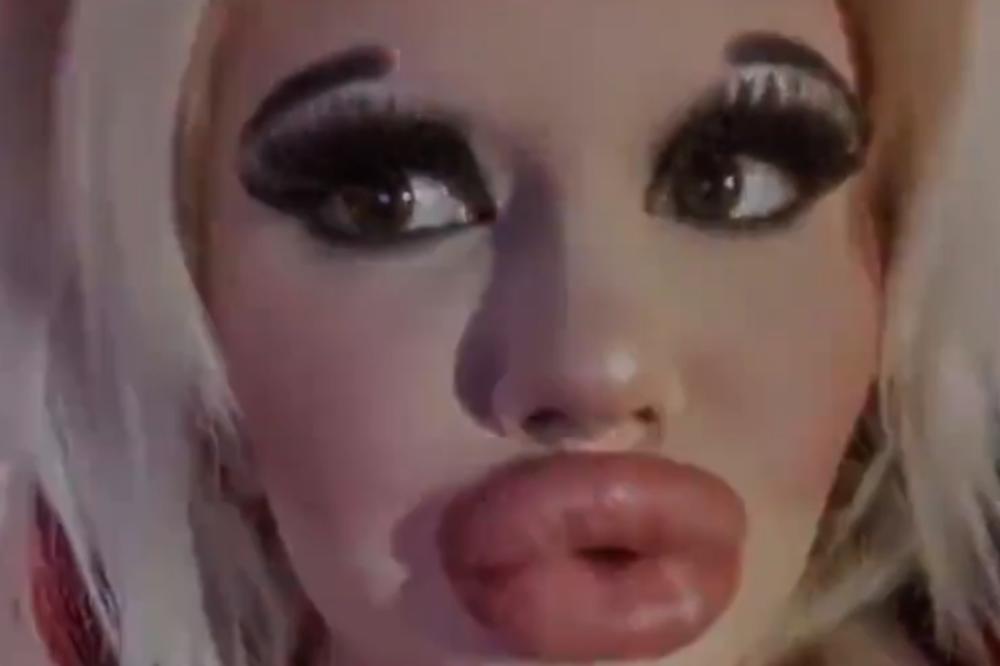 ANDREA TVRDI DA IMA NAJVEĆE USNE NA SVETU: A kada vidite na koga želi da liči, FRAPIRAĆETE SE (FOTO)