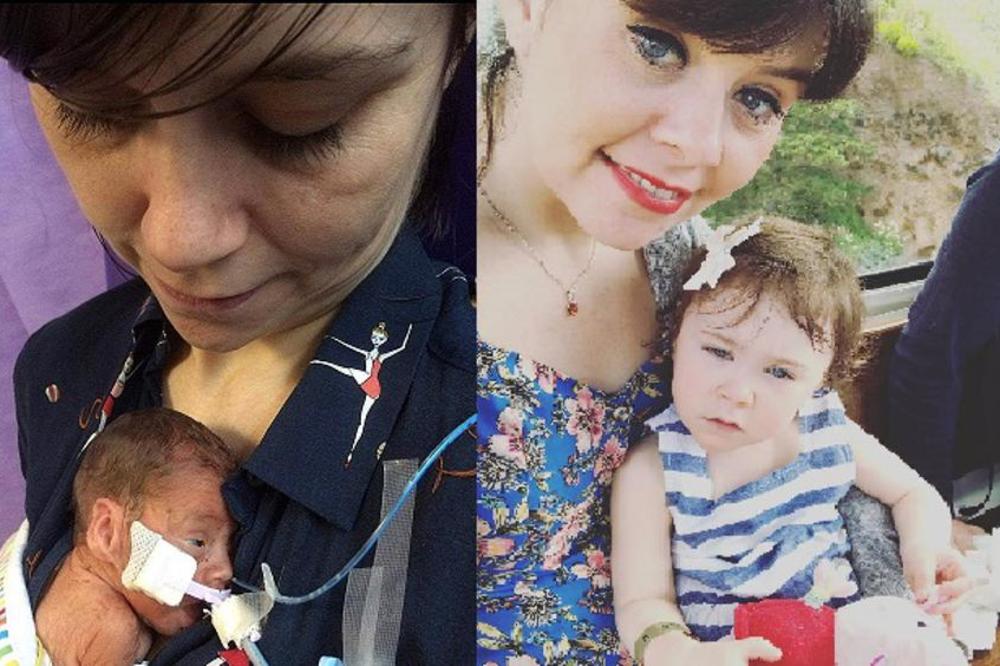 RODILA SE SA 460 GRAMA I PROZIRNOM KOŽOM: Ova beba je imala brojne probleme, ali je njen OPORAVAK zadivio lekare!