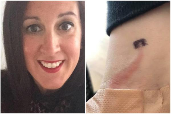 PRIMETILA OVO NA RUCI SINA, I ODLUČILA DA GA ODVEDE LEKARU: Da nije to uradila, UMRO BI (FOTO)