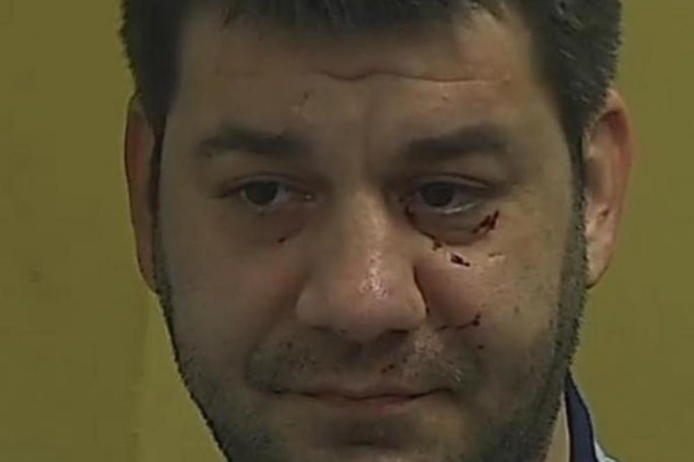 JELENA JE SVOJE NASILJE POKAZIVALA I U PAROVIMA, TUKLA JE IVANA I PRAVILA MU OŽILJKE: Sve je ukazivalo na TRAGEDIJU