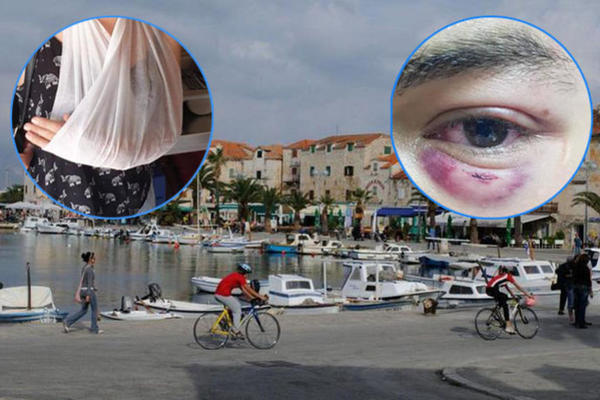 DI JE SRBIN? Ovo su viknuli, pa počeli da nas biju! Potresna ispovest momka pretučenog u Hrvatskoj