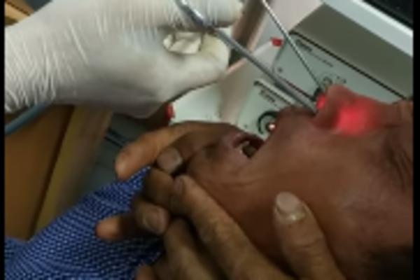 IZ NOSA MU IZVADILI PARAZITA KOJI JE TU BORAVIO 2 MESECA! Pacijent ostao u čudu, lekari još više! (VIDEO)